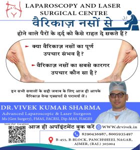Varicose veins, laser surgery, laparoscopy, pain relief, advanced treatment, Dr. Vivek Kumar Sharma, Ajmer, medical consultation, health care, vein treatment Advanced Treatment for Varicose Veins: Expert Care by Dr. Vivek Kumar Sharma